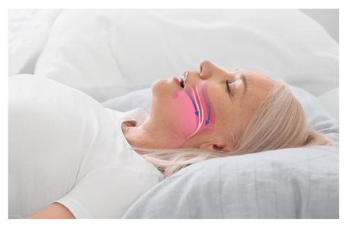 Wake Up Refreshed: Tips and Tricks for Managing Sleep Apnea
