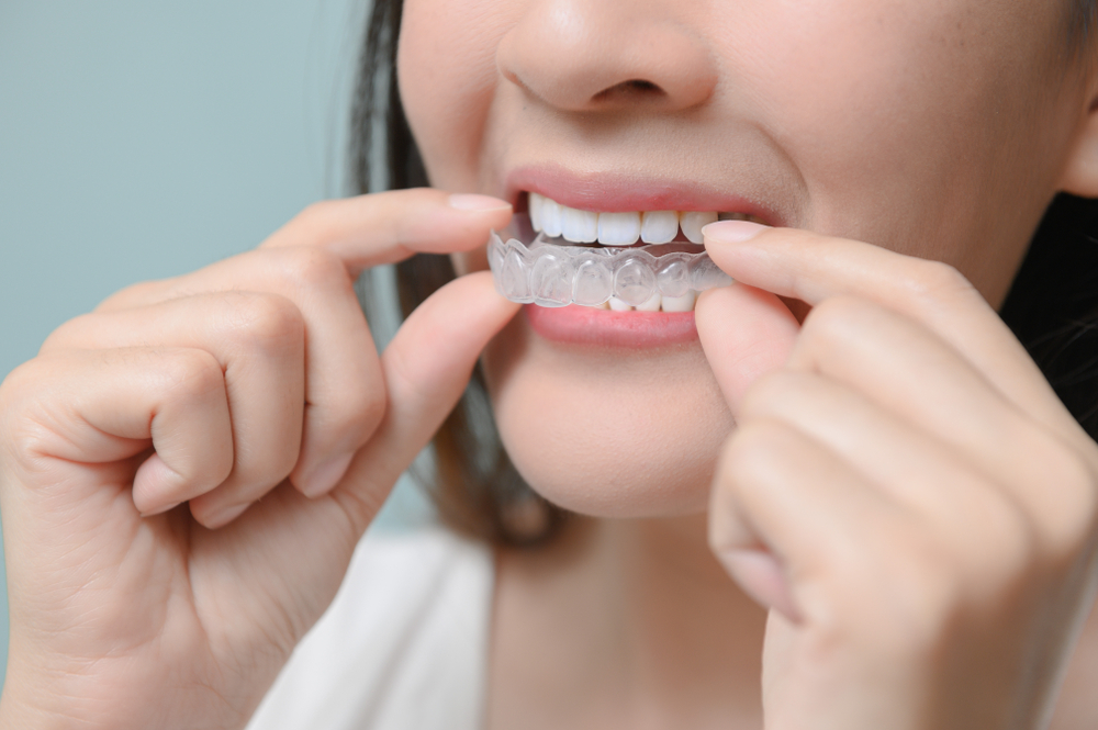 Invisalign vs. Braces: Making the Right Choice