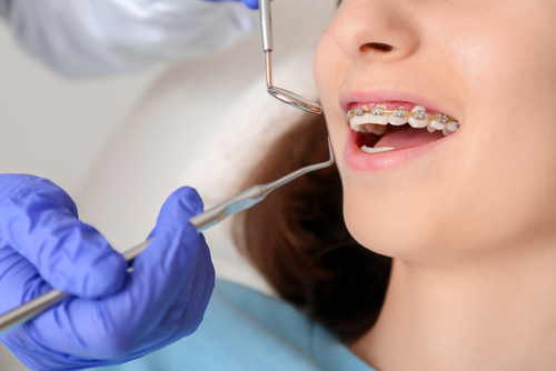 How Orthodontic Treatment Can Improve More Than Just Your Smile